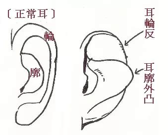 反耳骨面相